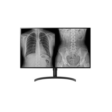 ECRAN LG 32 NOIR LED IPS 16:9 8MP DCI-P3 98% 5ms 350cd/m² UHD 3840x2160. Flicker Safe & Reader Mode HDMI,2Display Port. Bords fin. pied réglable en hauteur